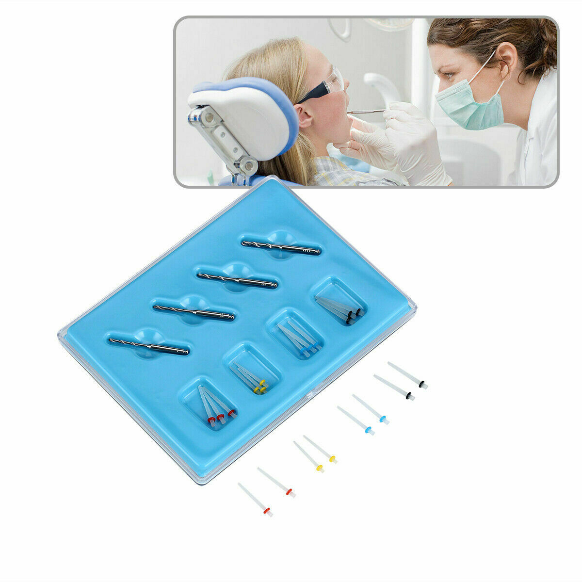 20 Pqts Dental AAA Tornillo de Resina de Poste de Fibra Alta Intensidad Hilo V