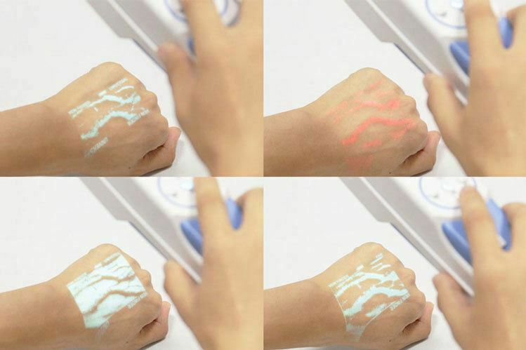 Handheld Portable Vascular Vein Viewer Venipuncture Finder Illumination IV