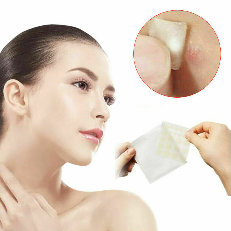 36x Skin Tag & Acne Patch - NEW Hydrocolloid Acne and Skin Tag Remover Patches..