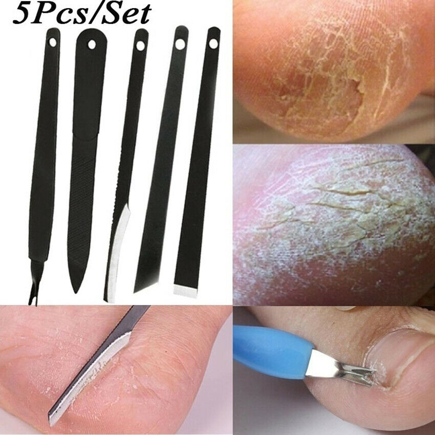 5pcs/set Nail Cuticle Pusher Remover Manicure Pedicure Stainless Steel Tool