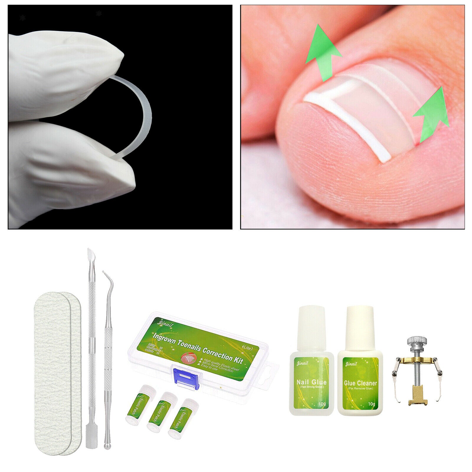 Foot Care Elastic Pedicure Patch with GlueIngrown Nail Straightening