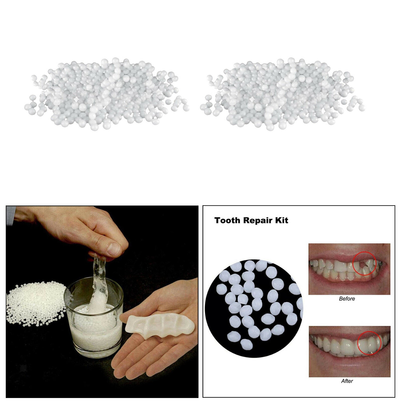 50g Thermal Beads Teeth Veneers Temporary Teeth Repair Kit Thermal Beads