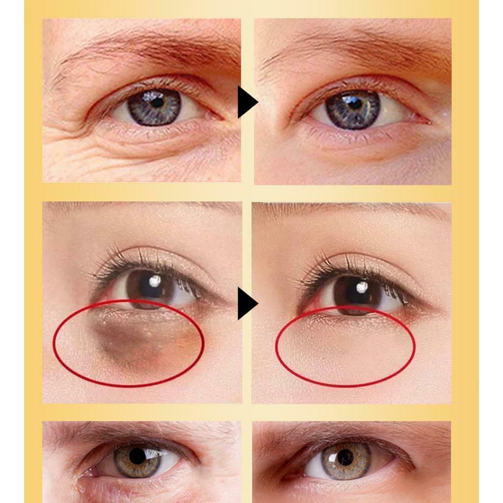 Eye Essence Repair Synchronized Beauty Lift-Firm Anti Dark Circles Anti Age