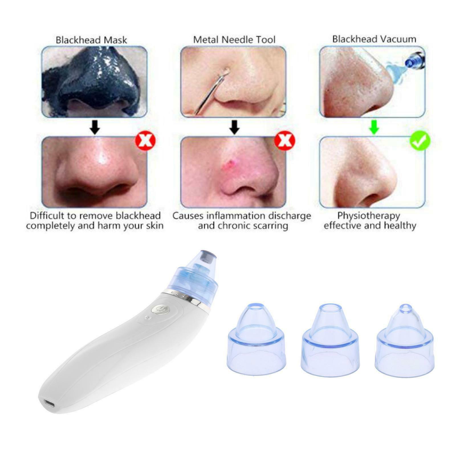 Electric Blackhead Remover Pore Vacuum Suction Facial Clean Skin Care