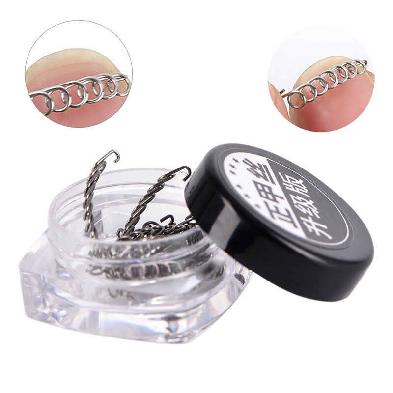 12Pcs Ingrown Toe Nail Correction Wire Fixer Pedicure Paronychia Recover GK S XC