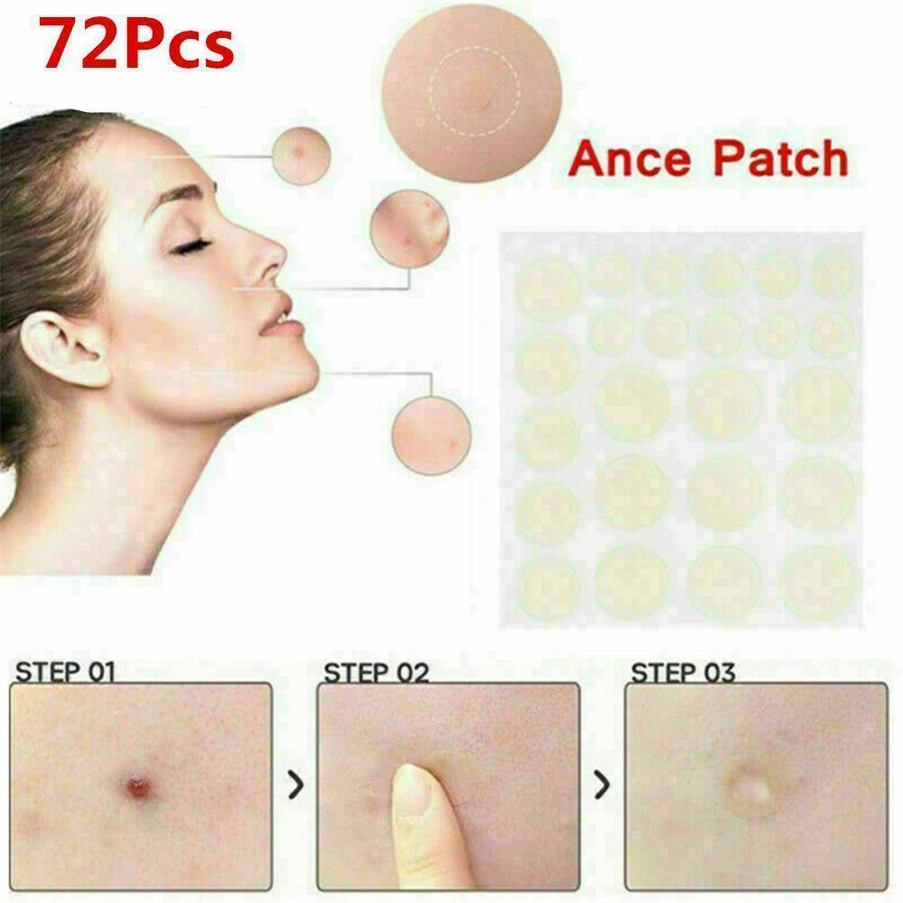 72PCS DERMOPATCHY ACNE SKIN TAGS PIMPLE REMOVER PATCH REMOVAL FACIAL CARE SPOT !