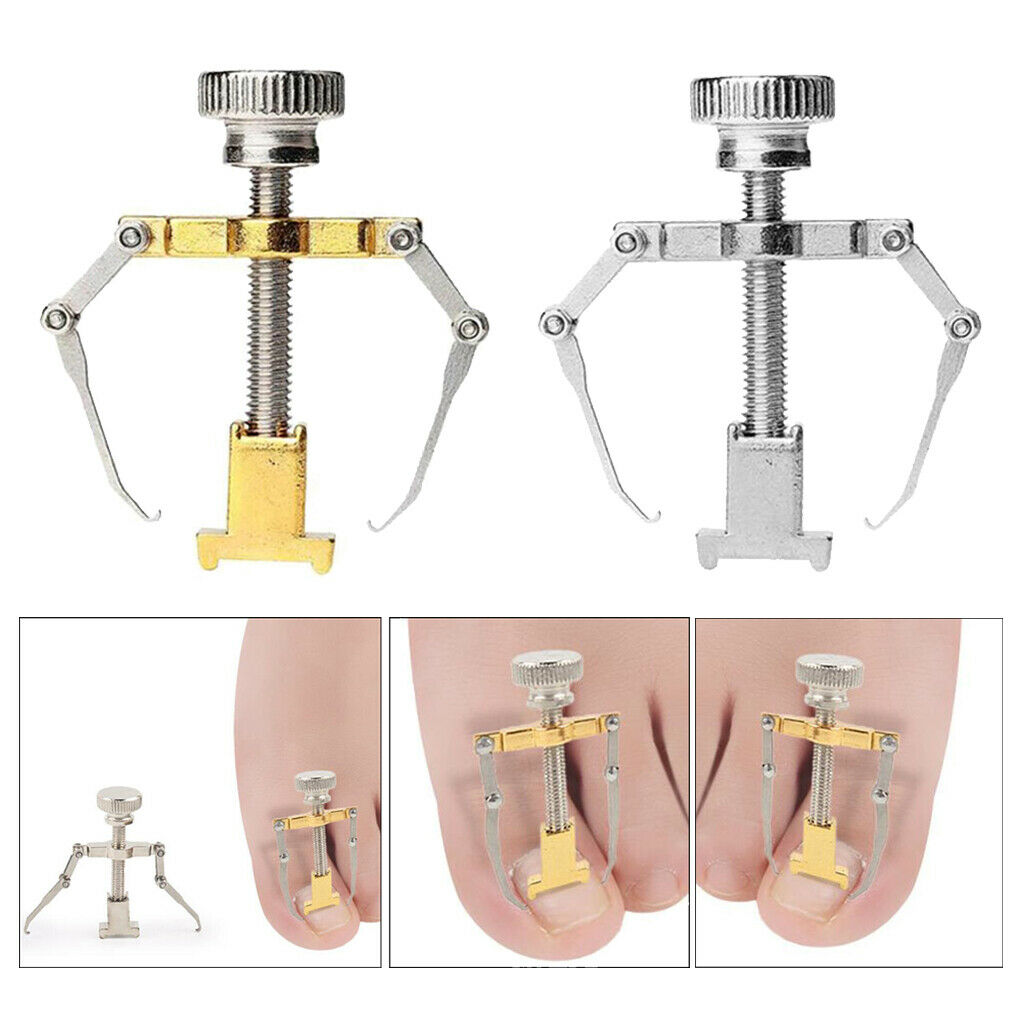 2 Pcs Pro Alloy Ingrown Toenail Correction Lifter Toenail Corrector Toe Clamps