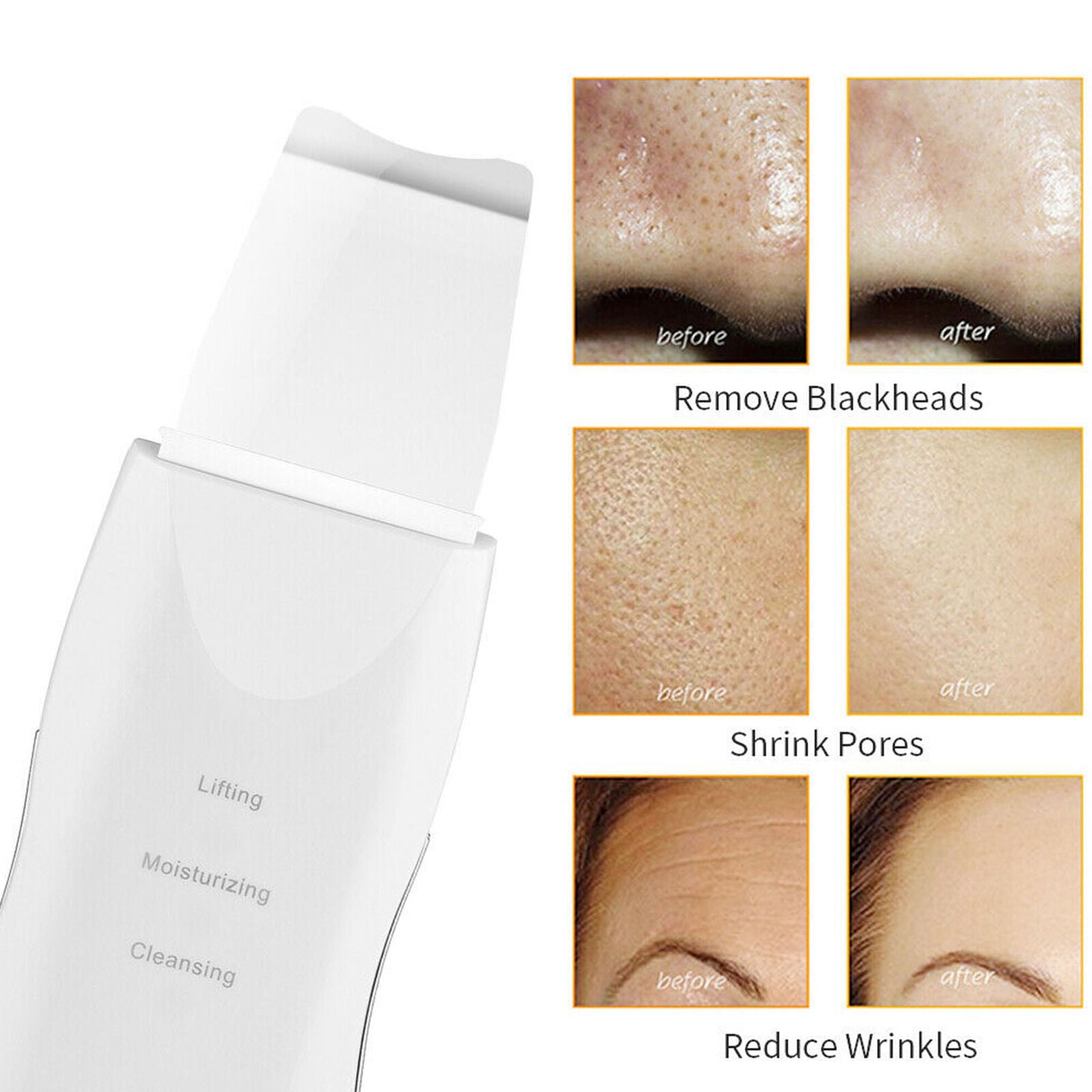 Ultrasound Ion Skin Scrubber Peeling Blackhead Remover Facial Pore Deep Cleaning
