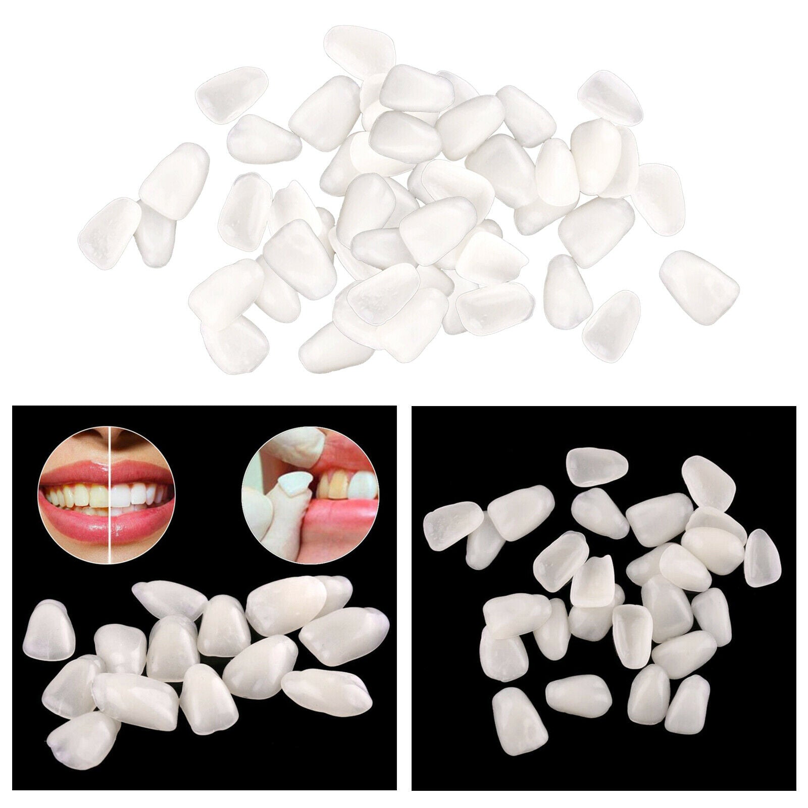 Teeth Temporary Crown Veneers Anterior Front Kit Dentist Products White