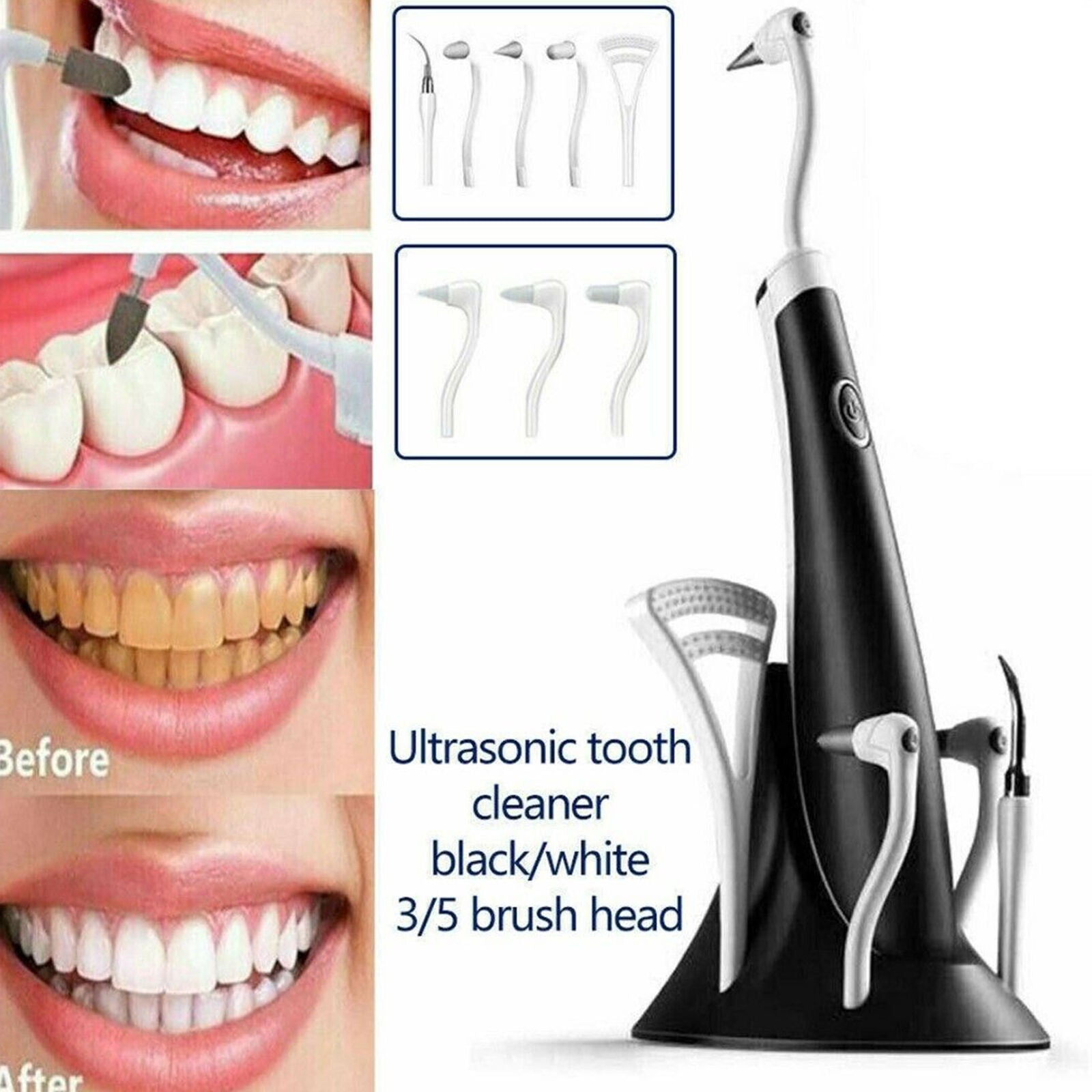 Tooth Polishing Cleaner Ultrasonic LED Electric Oral Teeth Cleaning Kit + 5 Tips