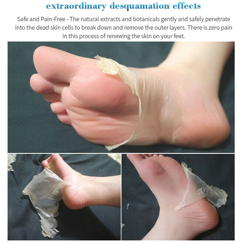3 Pair Exfoliating Scrub Foot Care Peeling Sock Baby Soft Feet Removes Dead Skin