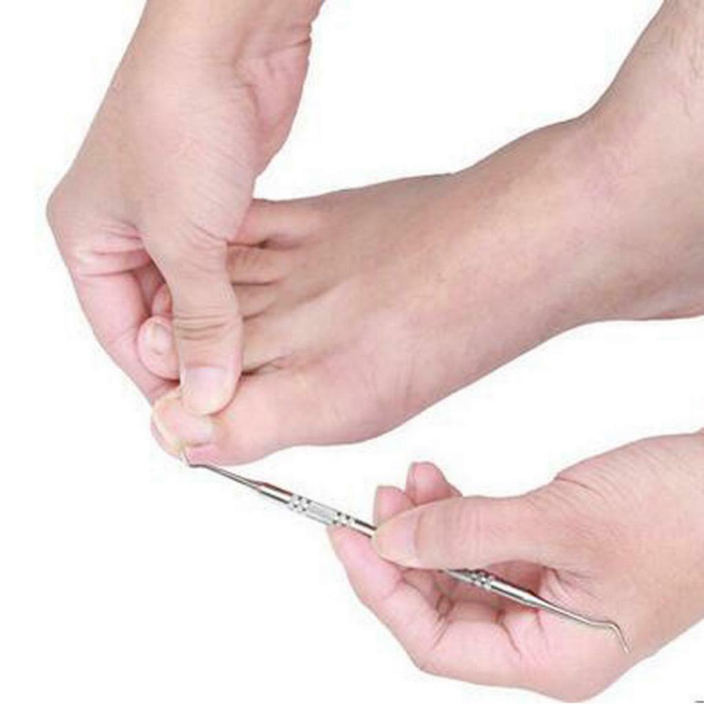 3pcs Ingrown Toe Nail Fixer Pedicure Toe Nail Correction Lifter Tool Set