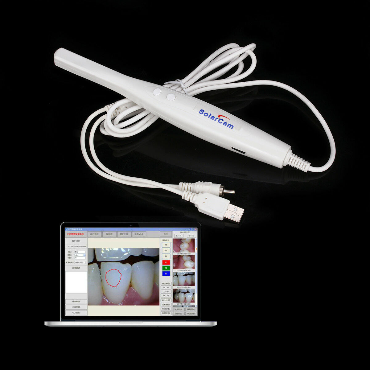 SolarCam Dental CMOS 1/4 Intraoral Oral Camera 8 LED U801 TV/AV 16GB SD Sleeves