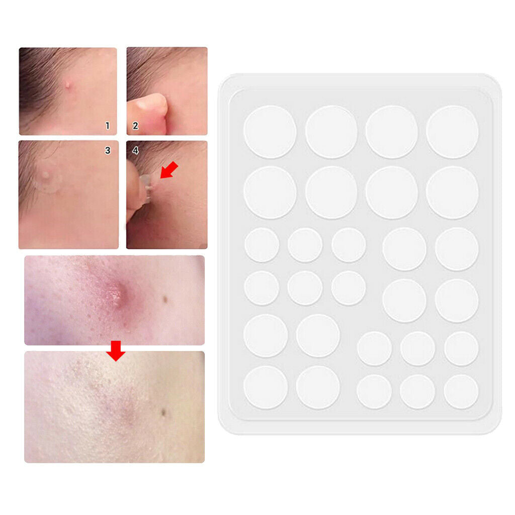 28Pcs Hydrocolloid Acne Patch Invisible Facial Spot Face Skin Care Night Use