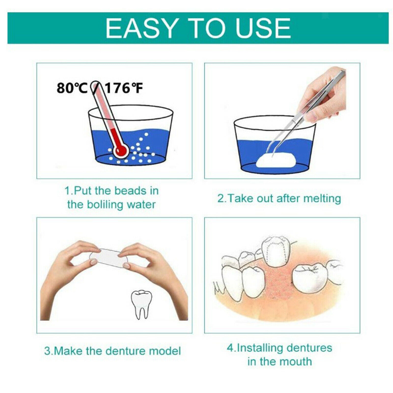 Thermal Beads Teeth Veneer Moldable Denture Temporary Tooth Repair Tools 5g