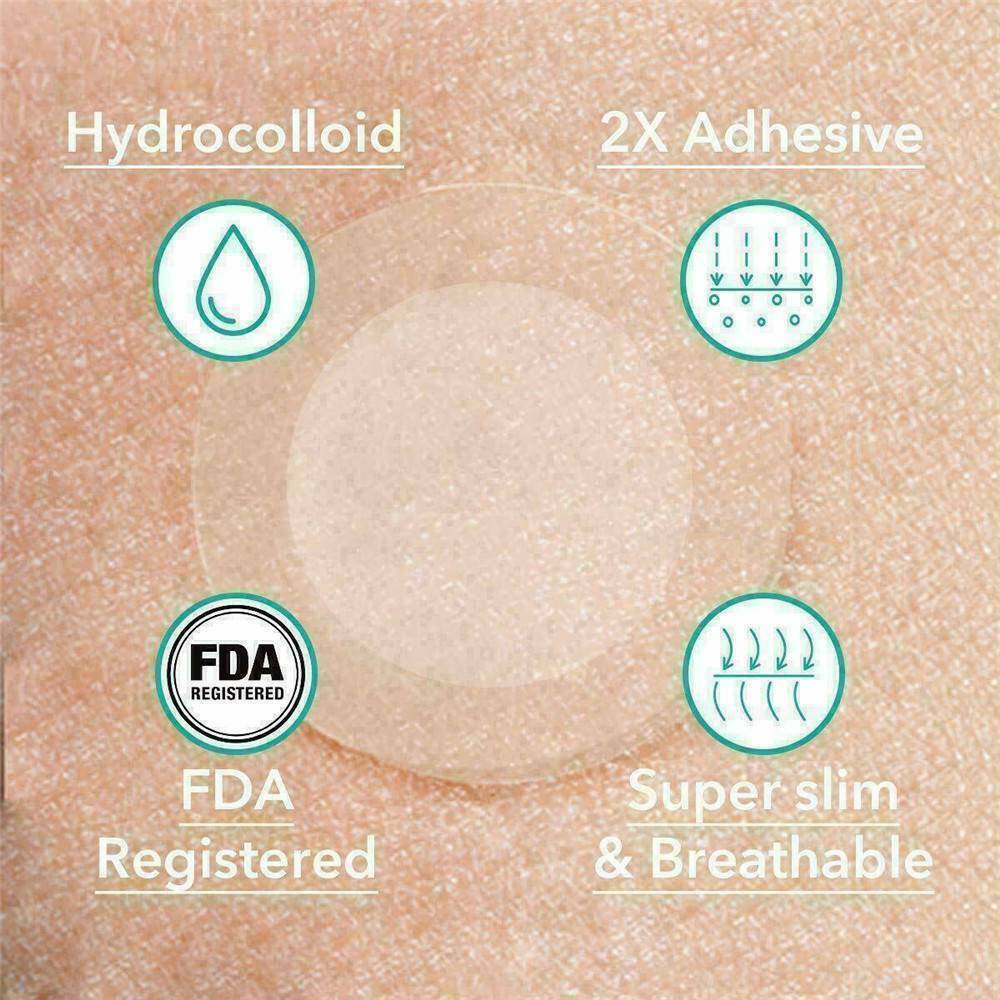 72PCS DERMOPATCHY ACNE SKIN TAGS PIMPLE REMOVER PATCH REMOVAL FACIAL CARE SPOT !