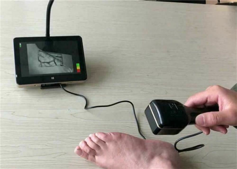 Vein Viewer Finder Locator LCD Touch Screen Imaging Illumination Visualization
