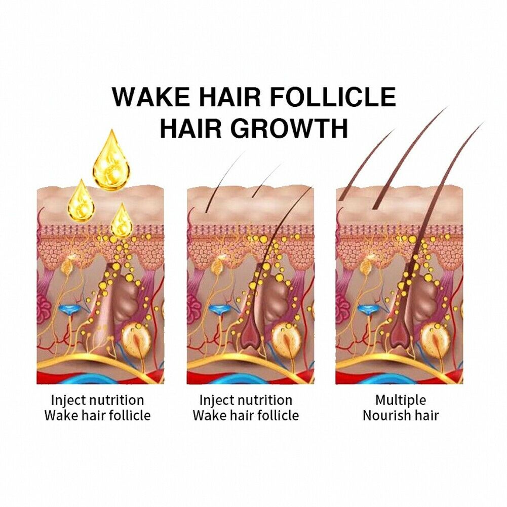 30ml Hair Growth Serum Hair Essence Nourishes, Softens and Repairs Damaged Hair