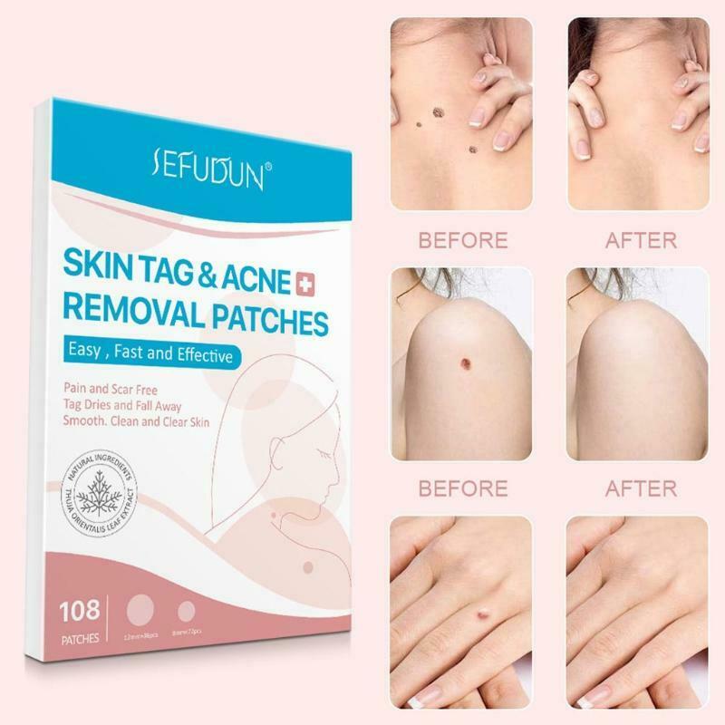 108 Patches Skin Tag Remover Patch Wart Removal Stickers Cover Conceals Tags