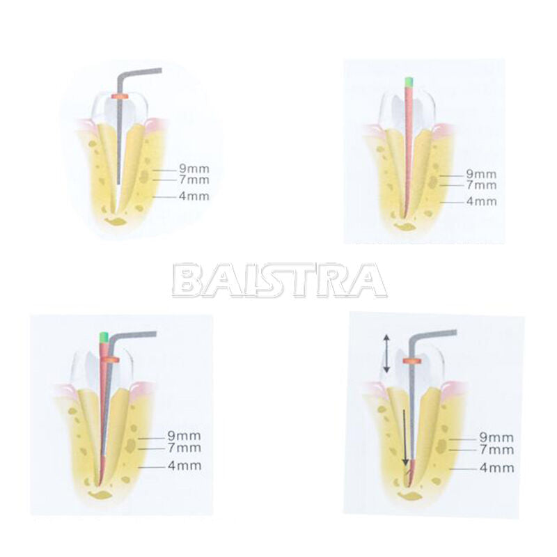 Dental Cordless Obturation Syatem Endo Heated Pen J1SS /Gutta Percha Points