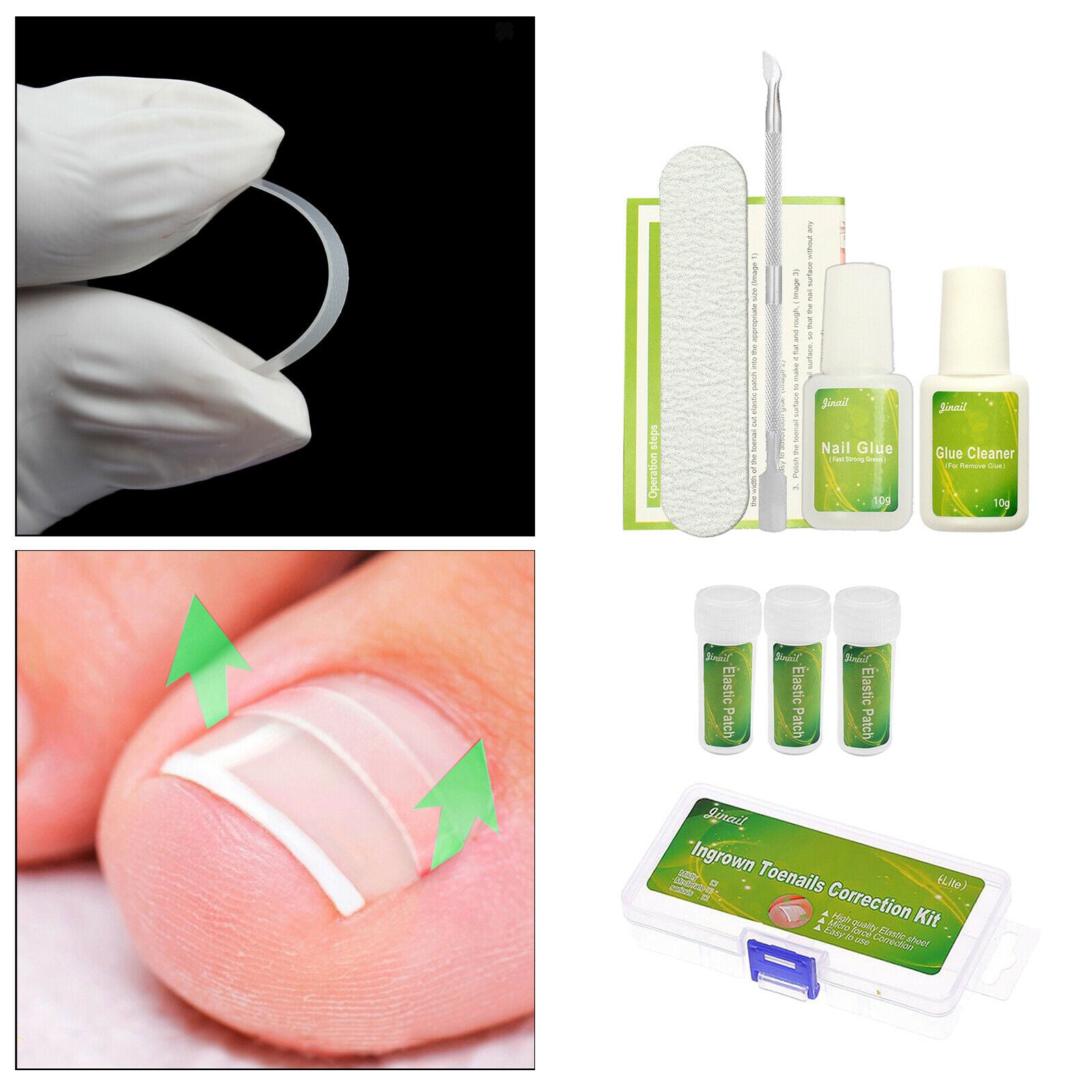 Ingrown Toenail Correction Tool Set Toenail Straightening Foot Nail Treament w/