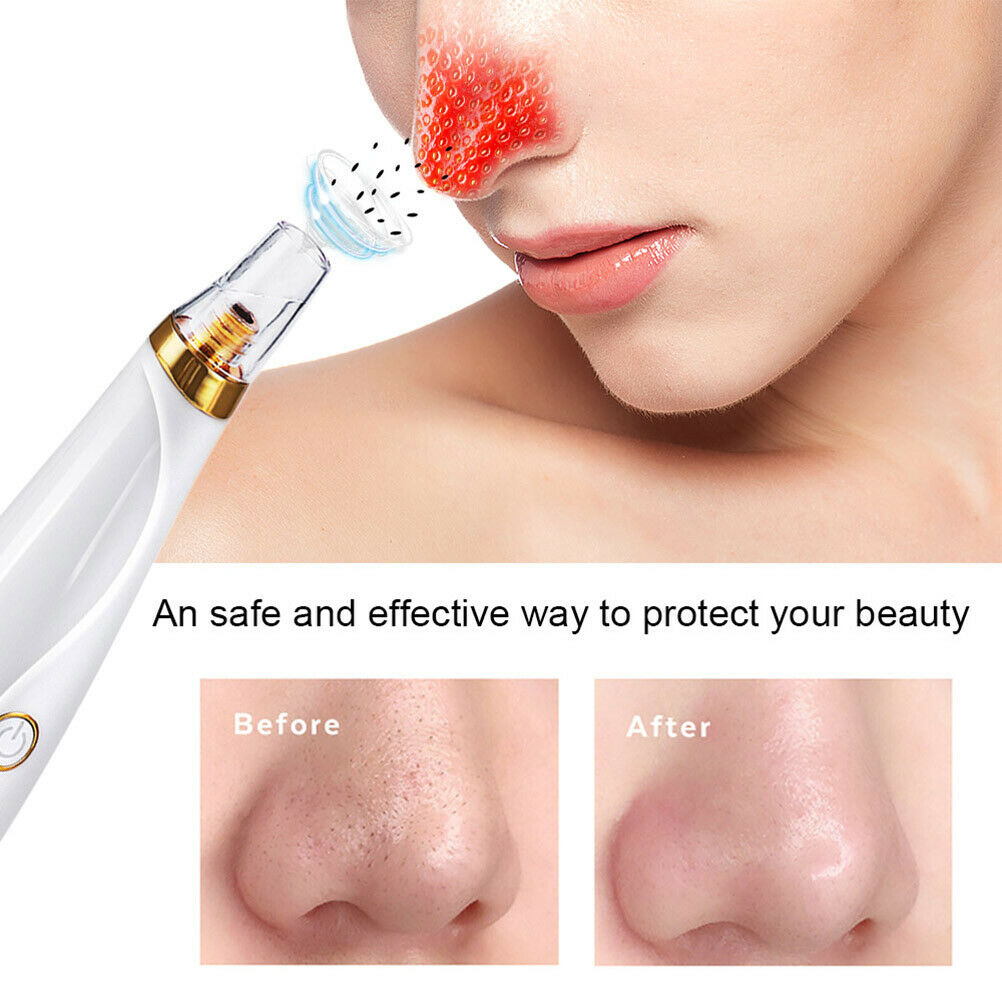 Blackhead Remover Vacuum Pimple Extractor Acne Removal Kit Face Cleaner Care