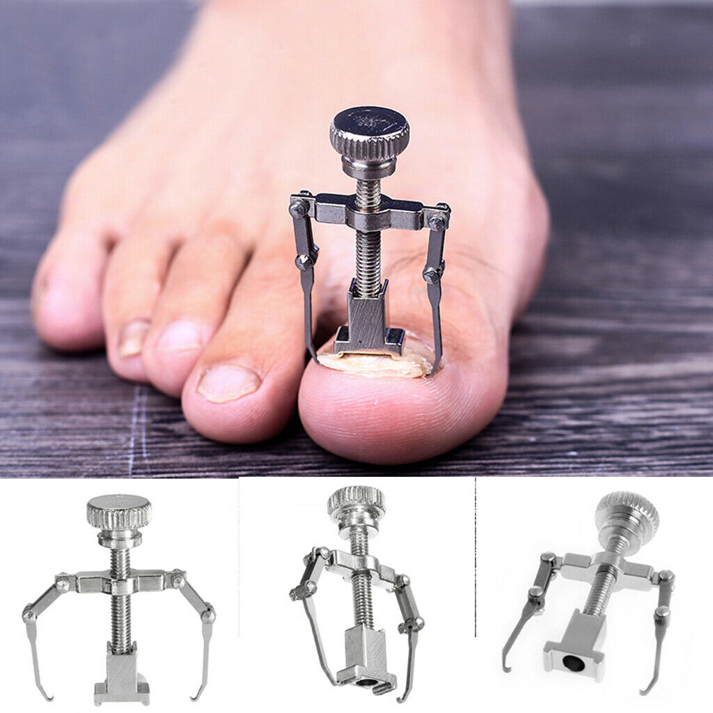 3pcs Ingrown Toe Nail Fixer Pedicure Toe Nail Correction Lifter Tool Set