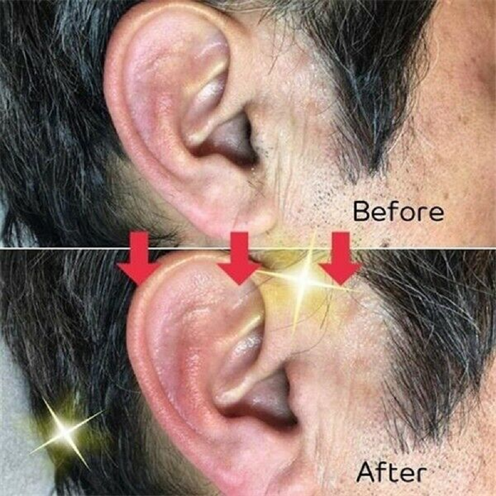 1+5x Nose Ear Hair Removal Wax Set - Sticks Easy Mens Nasal Waxing Strip Remover