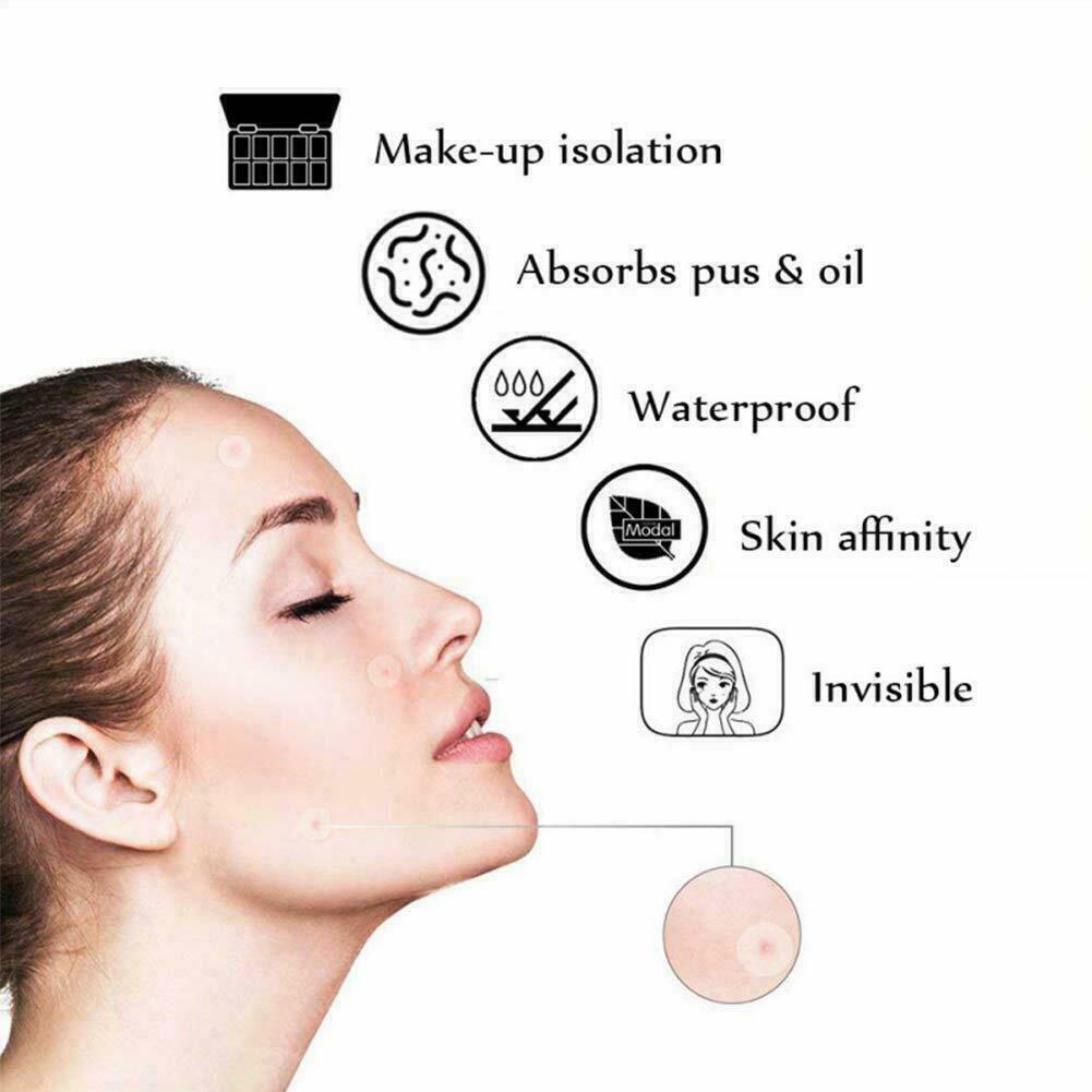 36Pcs Remover Patch Stickers Acne Set Pimple Master Treatment Skin Care Tools
