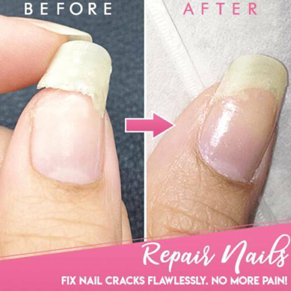 Cracked Nail Repair Gel Nail Damage Repair Phototherapy Glue DIY Nail Art Tips