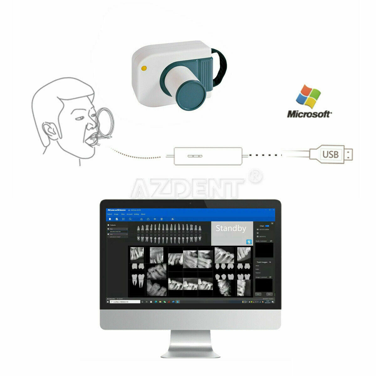 Dental X-ray Digital RVG Sensor 500mW X-Ray Imaging Intraoral Monitor Size:1.5