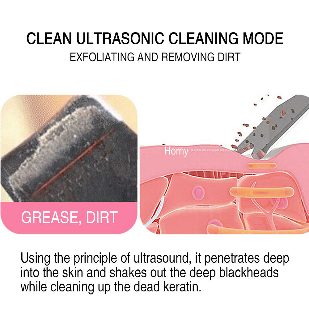 Electric Ion Ultrasonic Skin Scrubber Facial Spatula Cleaner Pore Peeling
