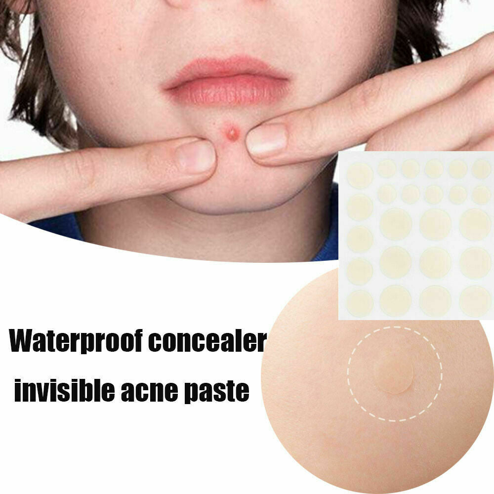 36X Skin Tag & Acne Patch Hydrocolloid Acne & Skin Tag Invisible Remover Patches