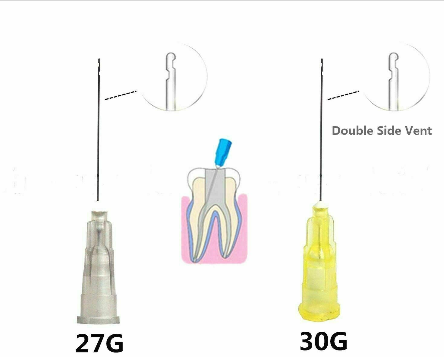500pcs Dental Disposable Syringe Tips 30G Endo Irrigation Needle 2 Side Holes