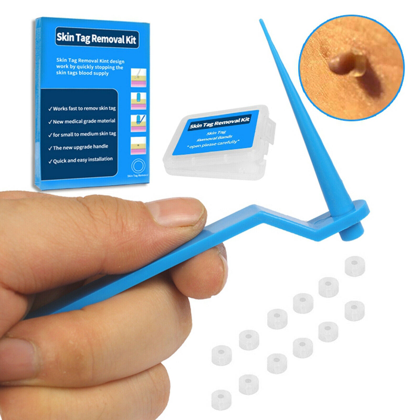 Beauty Home Non Toxic Skin Tag Removal Kit Tag Cure Remover Device 30x Bands