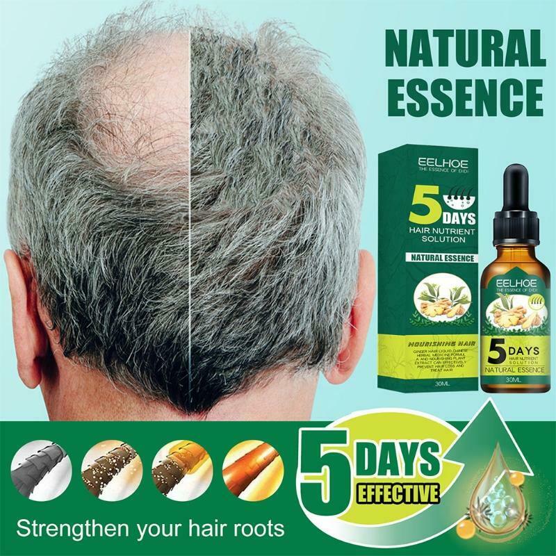 30ml Unisex Natural Ginger Extract Hair Growth Spray Care Essence Nourishing