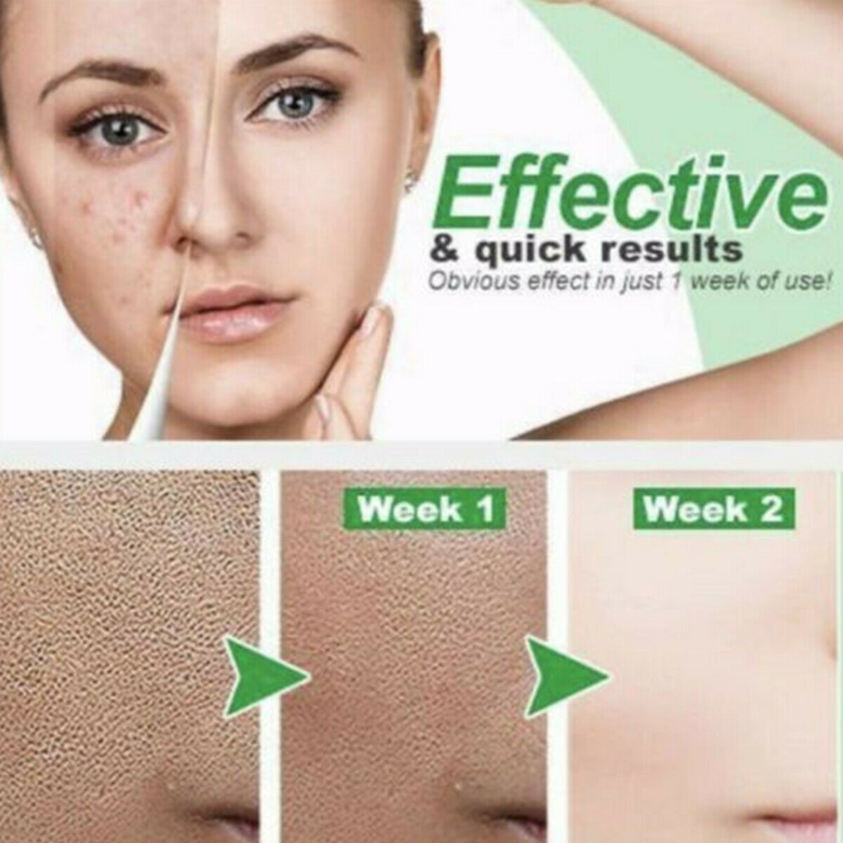 10ml Instant Perfection Serum Instant Perfection Serum Lactobionic Acid Face