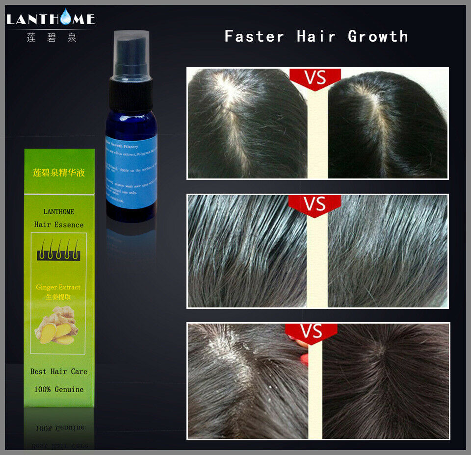 30ML Lanthome Herbal Fast Hair Growth Essence Liquid Anti Loss Treatment Sprayer