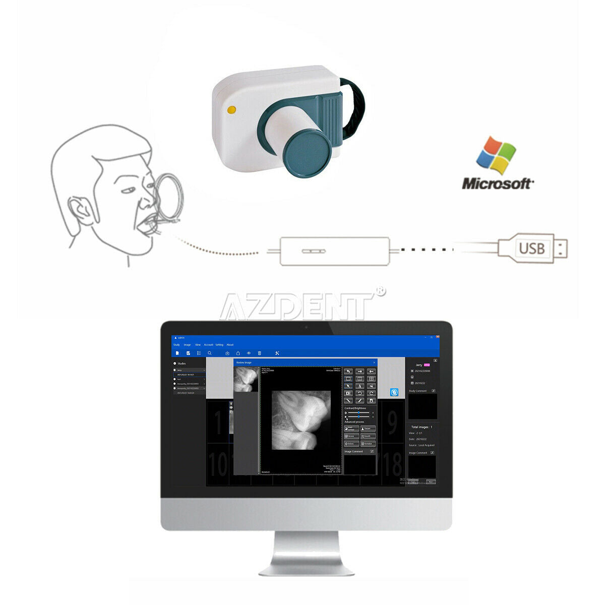 Warranty Dental Digital RVG X-Ray Sensor Image Machine XVS2121 fit Child & Pets