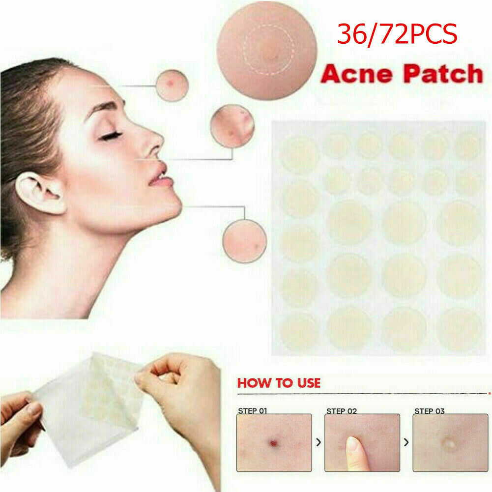 36Pcs Remover Patch Stickers Acne Set Pimple Master Treatment Skin Care Tools
