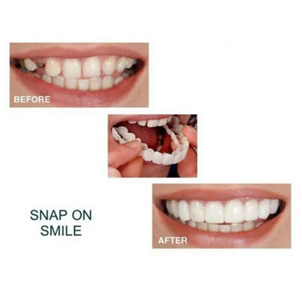 1Pc Soft  Flex Top Upper Cosmetic Teeth Cover Veneers Instant Smile