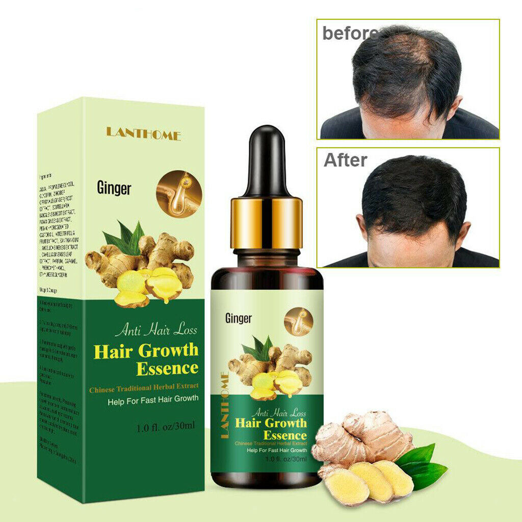 Hair Growth Serum, Hair Loss And Hair Loss Treatment, Hair Serum,