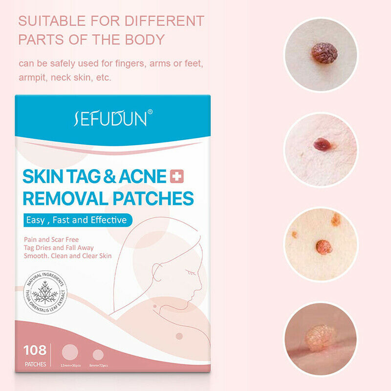 108pcs Skin Tag Remover Patch Hydrocolloid Acne Pimples Moles Zits War.l8