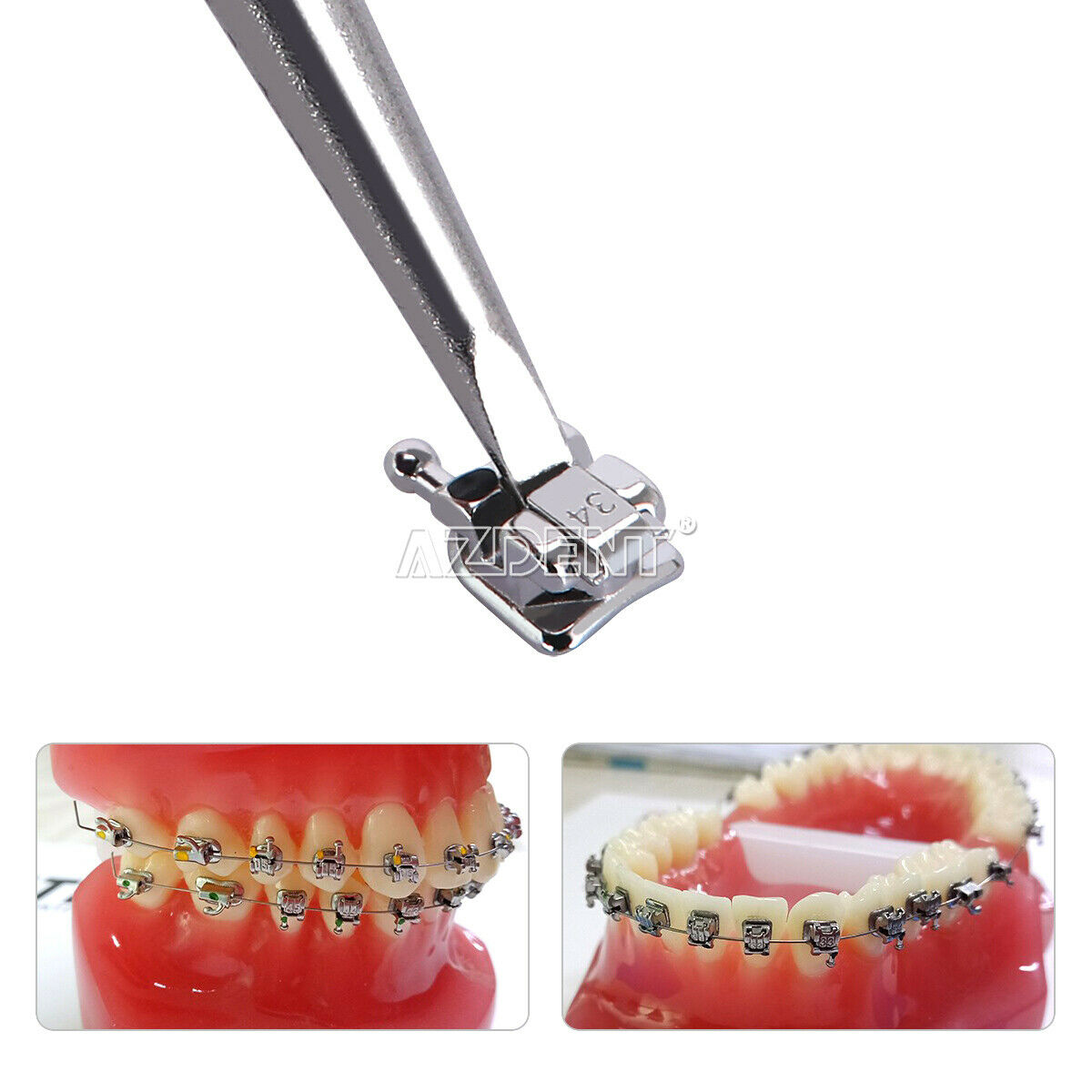 10 x Dental Passive Self Ligating Brackets Braces 3 4 5 Buccal Tubes MBT 0.022"