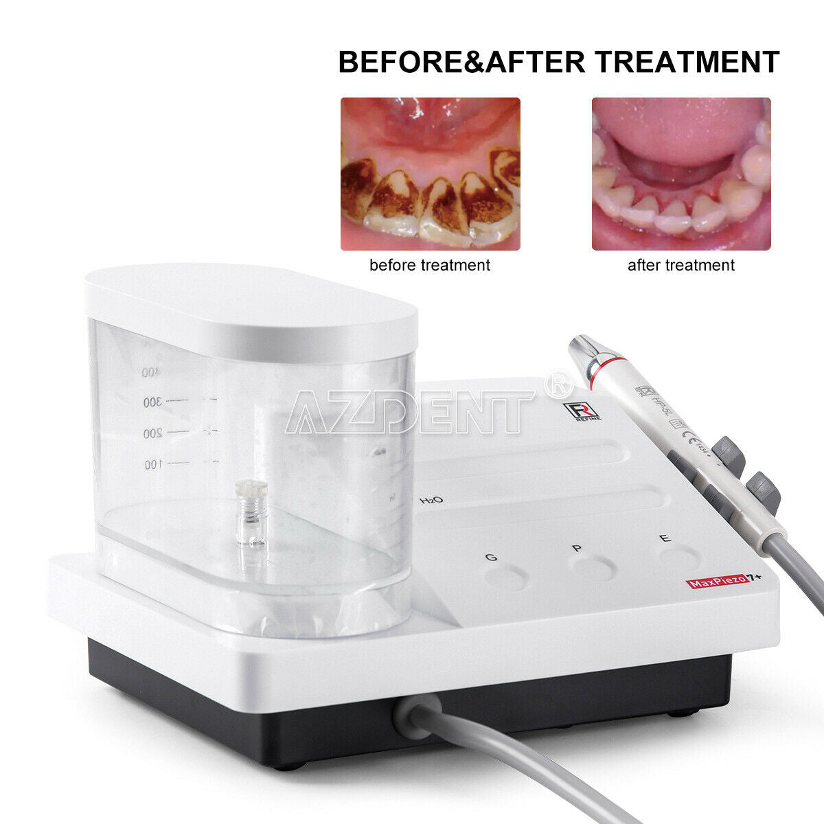 Dental Scaling Perio Endo Ultrasonic Scaler Touch Control & Bottle LED Handpiece