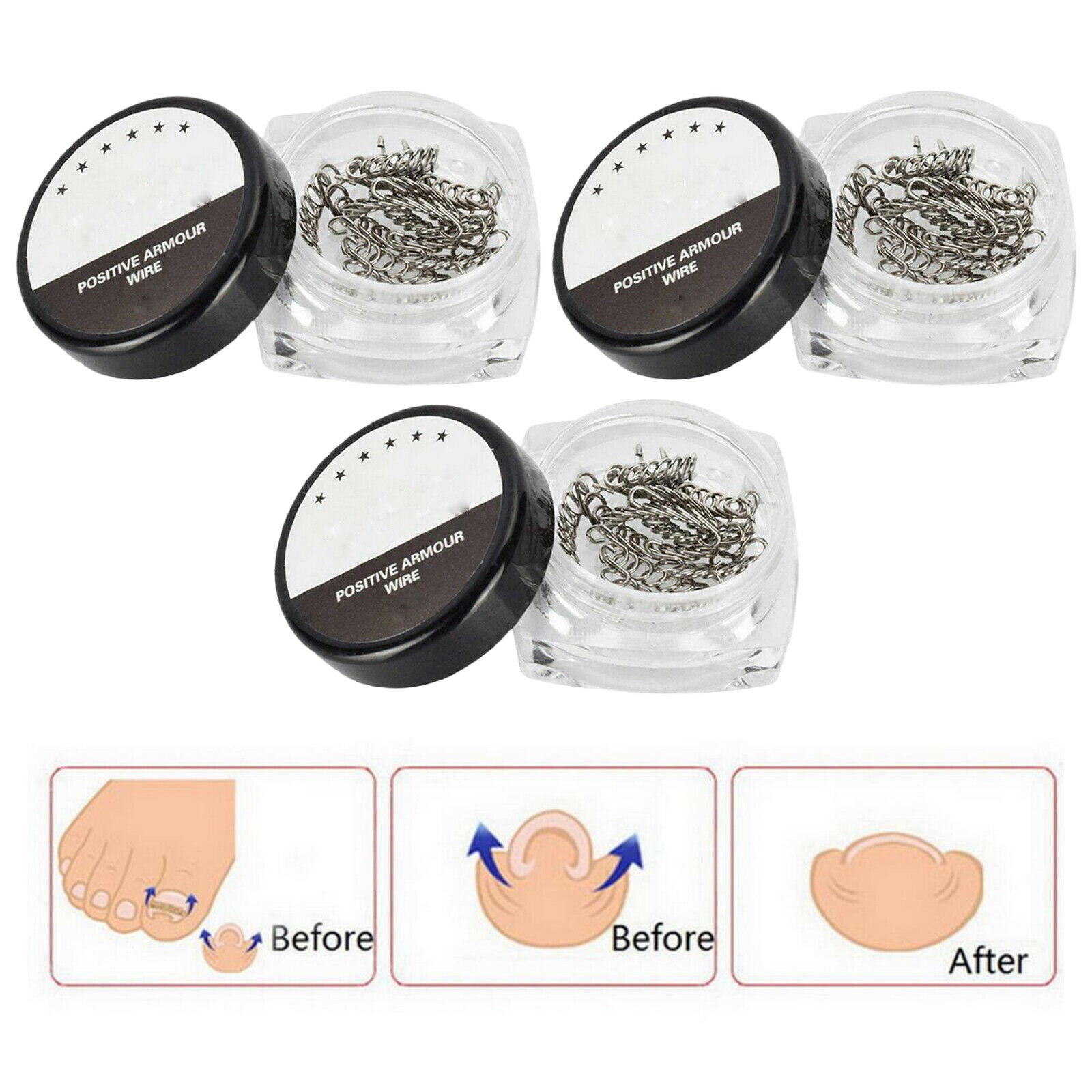 36pcs 3 box Bunion Toenails Correction Wire Fixer Wire Recover Care Nail Art