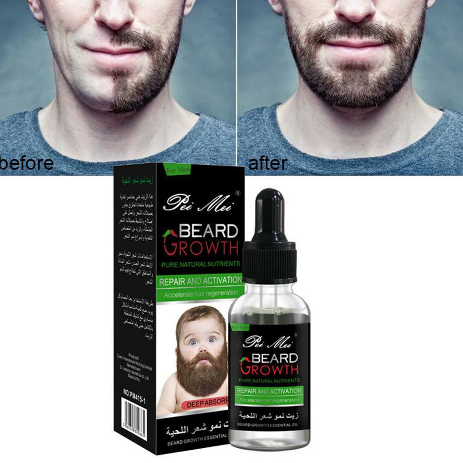 Men Mustache Beard Growth Oil Facial Hair Grooming Growth Treatments 30ml