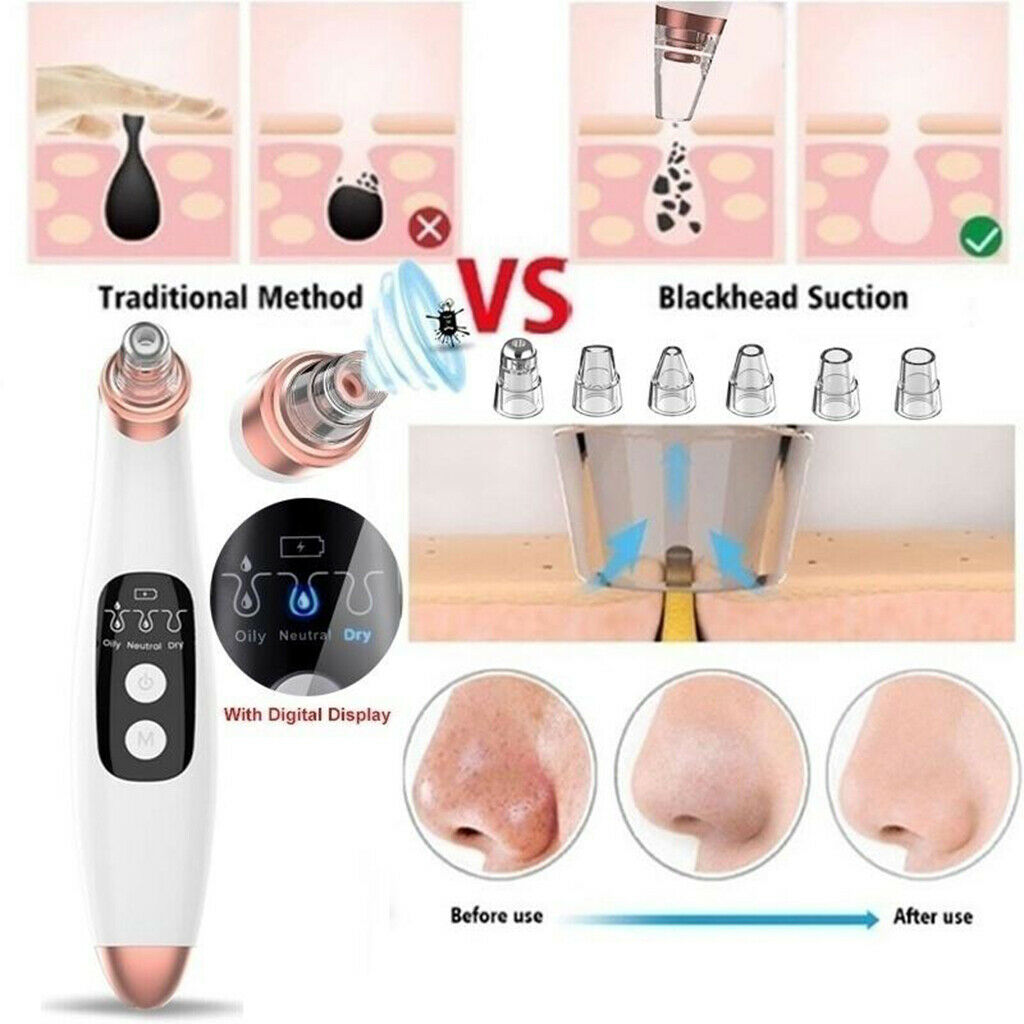 Electric Vacuum Cleaner Blackhead  Cleanser Pore Cleanser Face Care