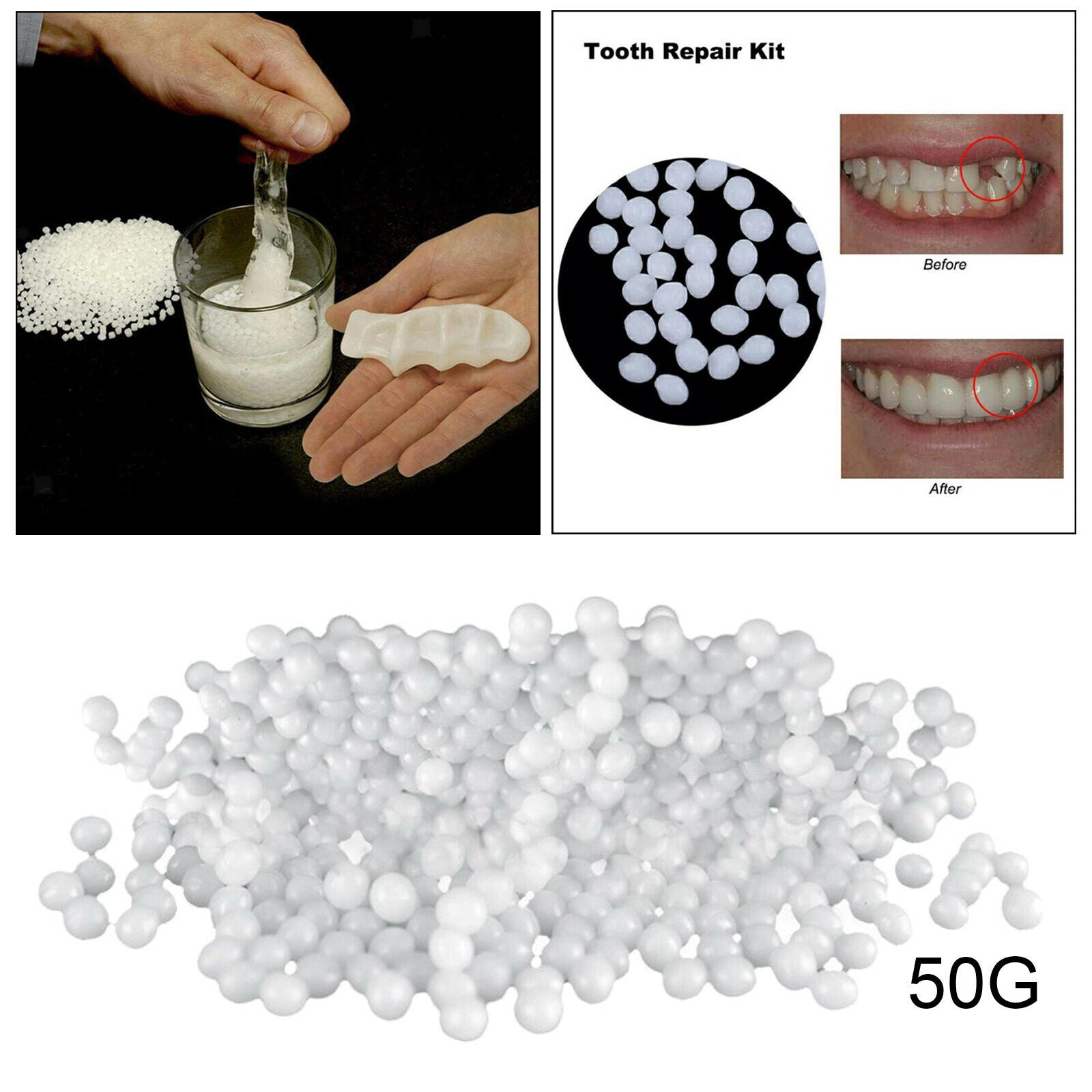 Dental Replacement Thermal Beads 150g Temporary Tooth Repair Kit Beads