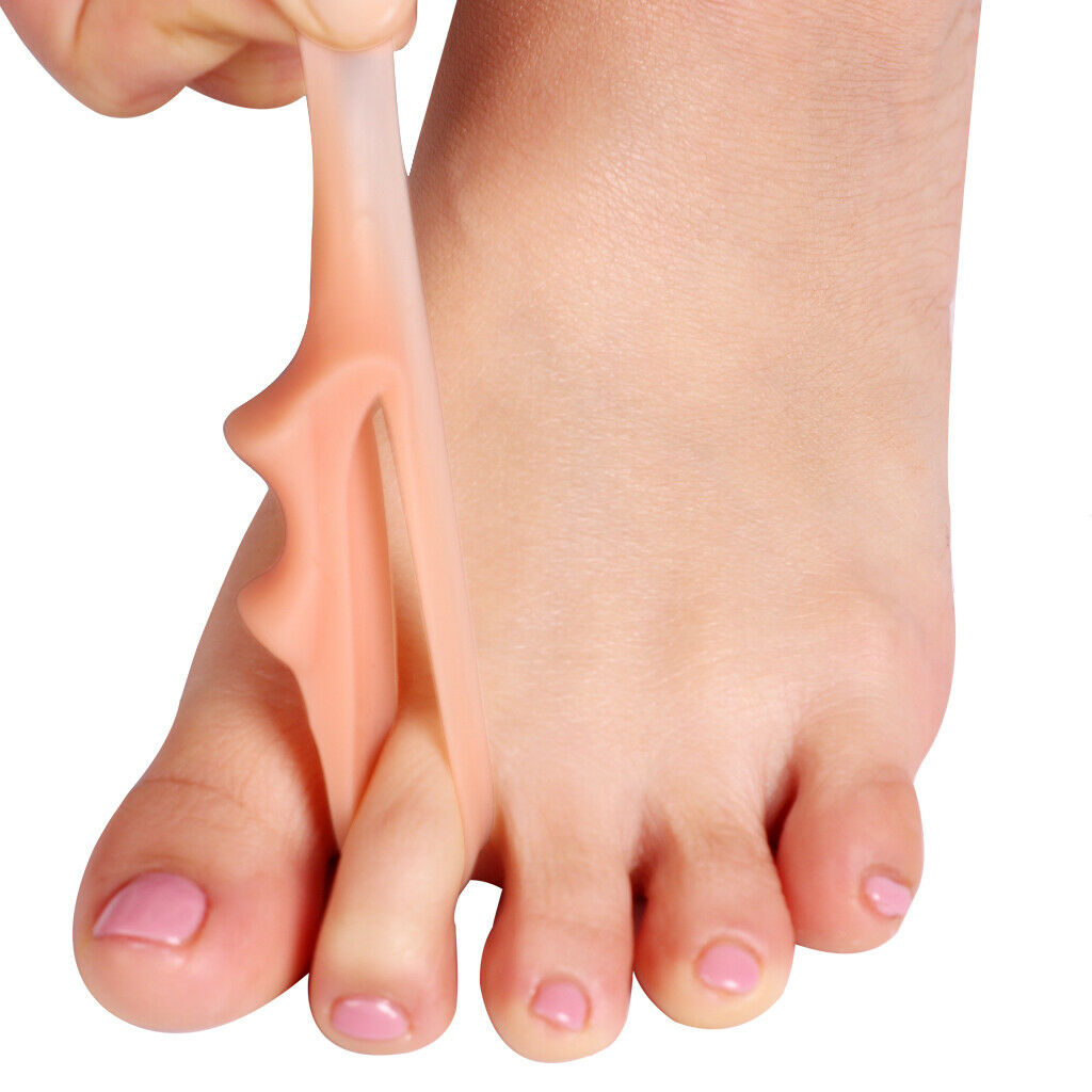 Ultra Soft Gel Hallux Valgus Spacer Corrector Insoles Cushion - 1 Pair